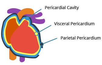 pericardial mesothelioma