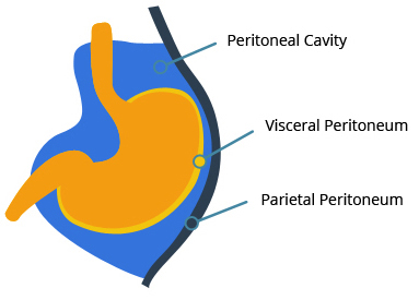 peritoneal mesothelioma